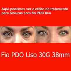 imagem Fio PDO Liso Olheira